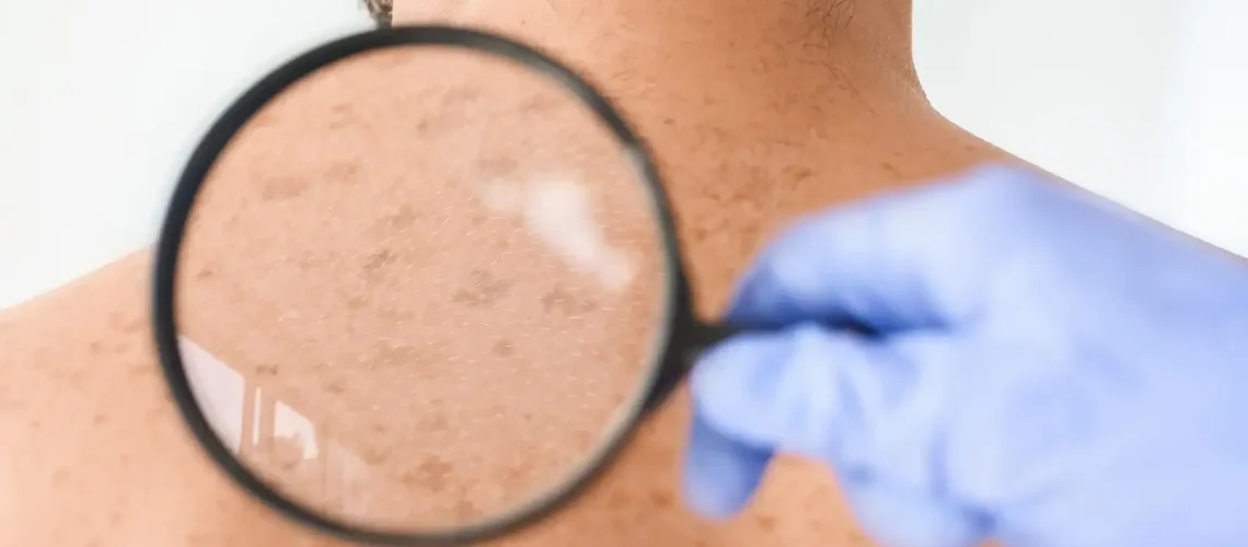 Doctor looking at freckles on a man's shoulder